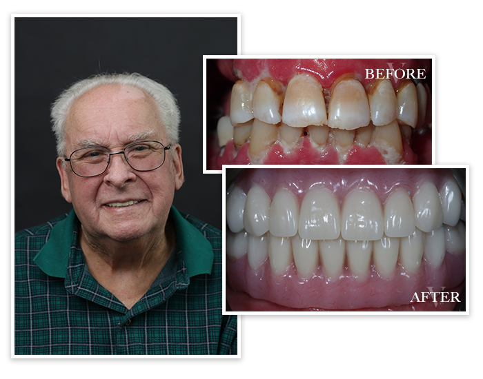 smile-gallery-collage-4 Smile Gallery Patient Collage 4