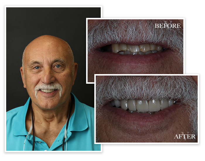 smile-gallery-collage-6 Smile Gallery Collage Patient 6
